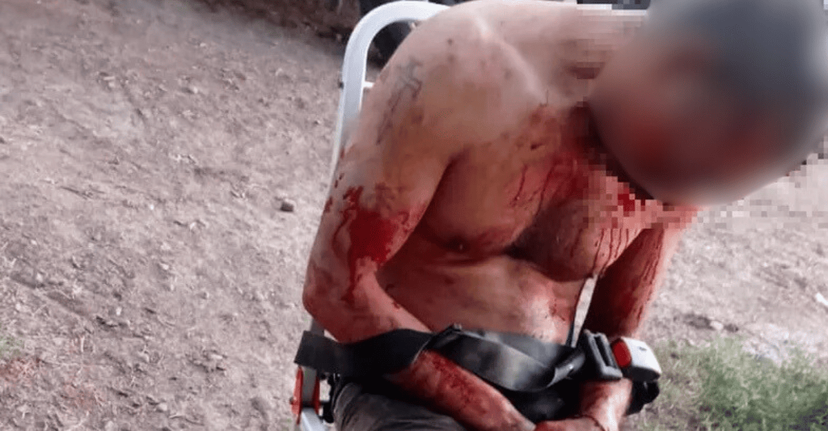 Sarmiento: un hombre golpeó a su tío con un palo con clavos tras confirmar una relación con su pareja.