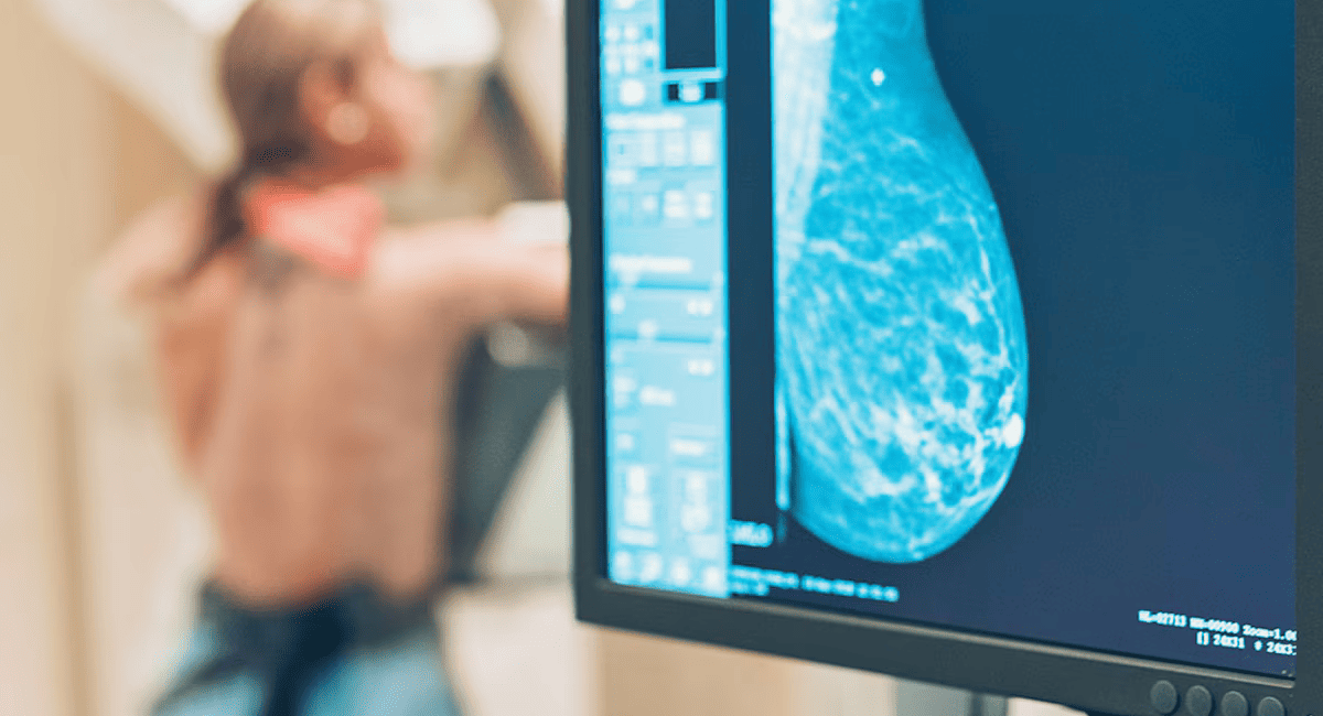 San Martín lanza un operativo gratuito para prevenir el cáncer ginecológico.