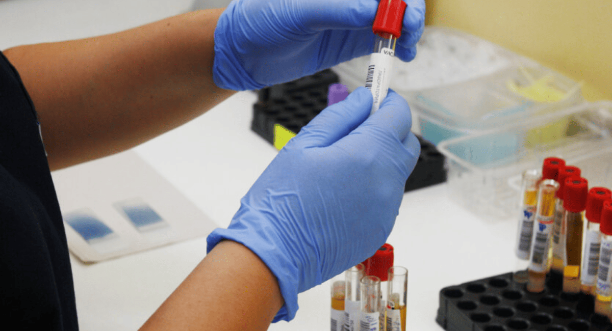 Santa Lucía lanza un operativo gratuito de detección y prevención de hepatitis
